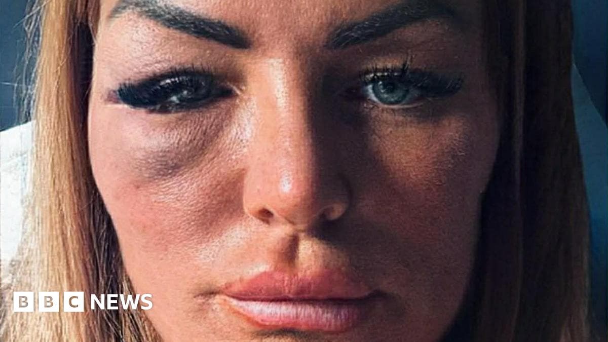 Woman recounts terrifying encounter with persistent man at pub